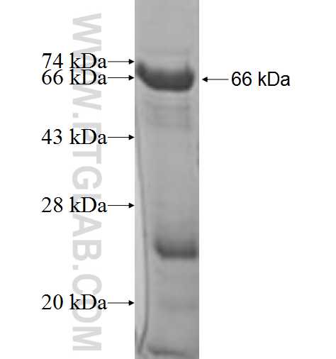 TOP1MT fusion protein Ag9857 SDS-PAGE