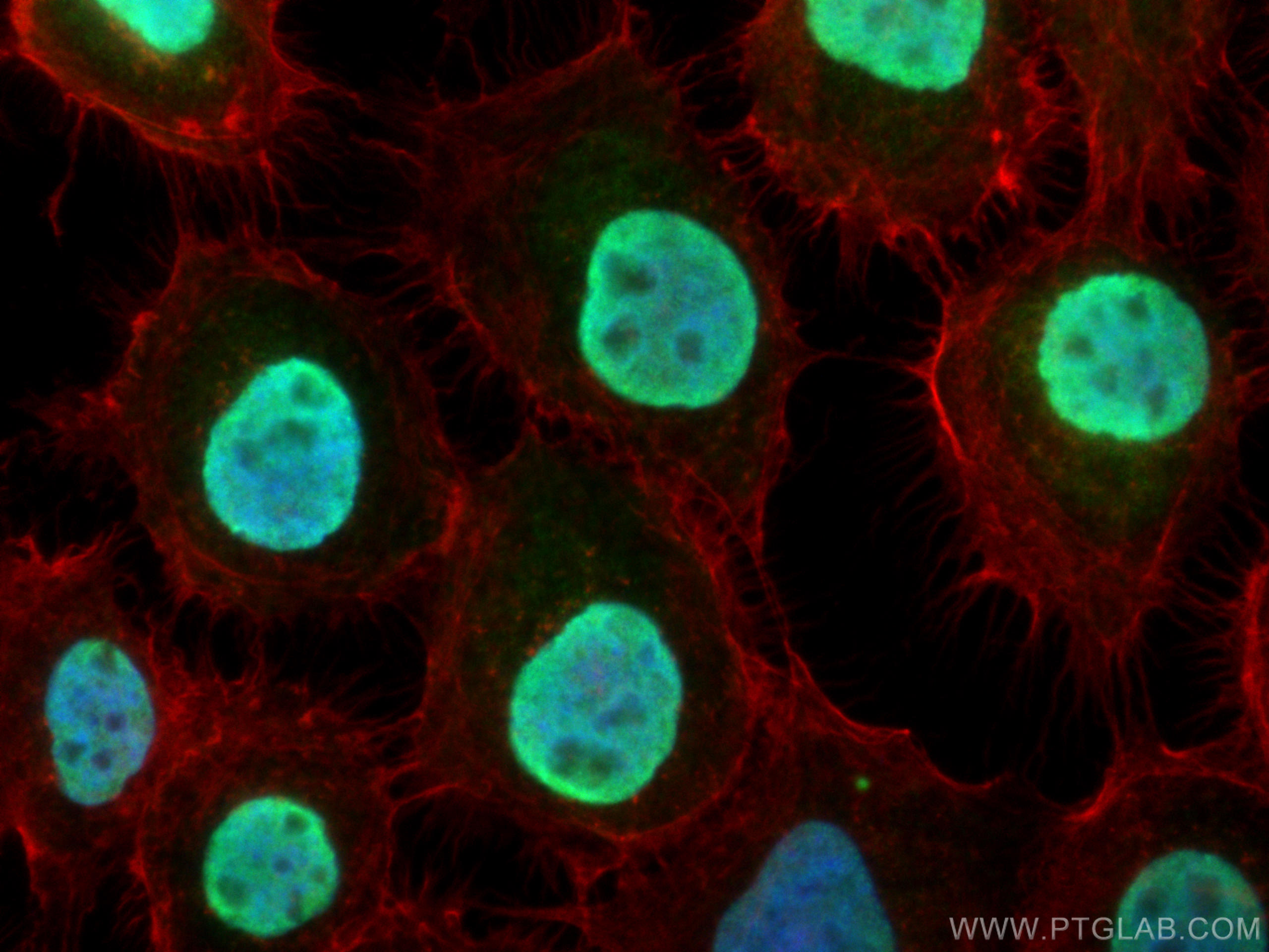 Immunofluorescence (IF) / fluorescent staining of A431 cells using TOP2A Polyclonal antibody (24641-1-AP)