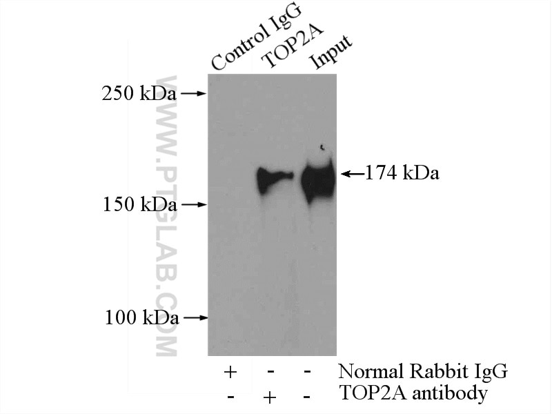 Immunoprecipitation (IP) experiment of HeLa cells using TOP2A Polyclonal antibody (24641-1-AP)