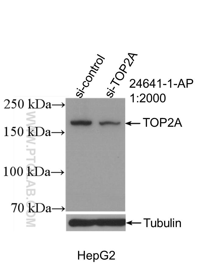 Western Blot (WB) analysis of HepG2 cells using TOP2A Polyclonal antibody (24641-1-AP)