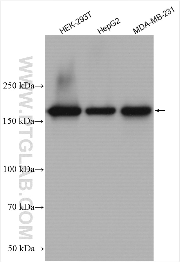 Western Blot (WB) analysis of various lysates using TOP2A Polyclonal antibody (24641-1-AP)
