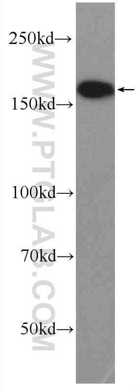 Western Blot (WB) analysis of HeLa cells using TOP2A Polyclonal antibody (24641-1-AP)