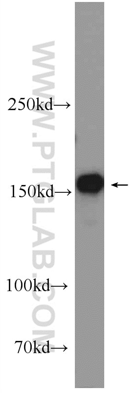 Western Blot (WB) analysis of HeLa cells using TOP2A Polyclonal antibody (24641-1-AP)