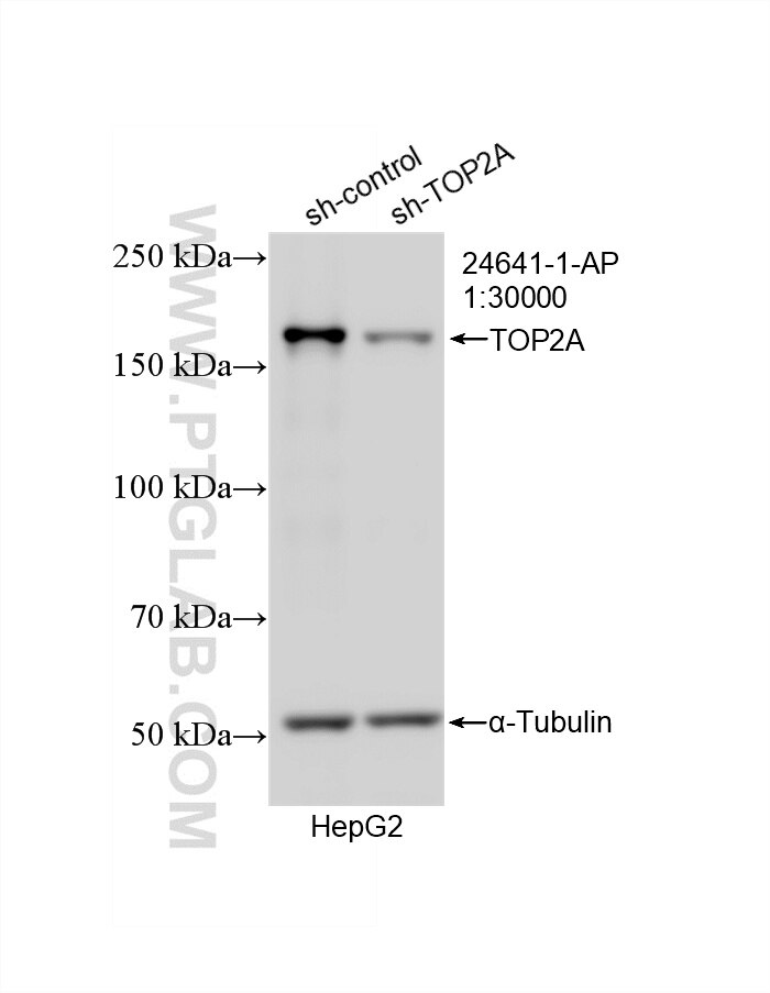 Western Blot (WB) analysis of HepG2 cells using TOP2A Polyclonal antibody (24641-1-AP)