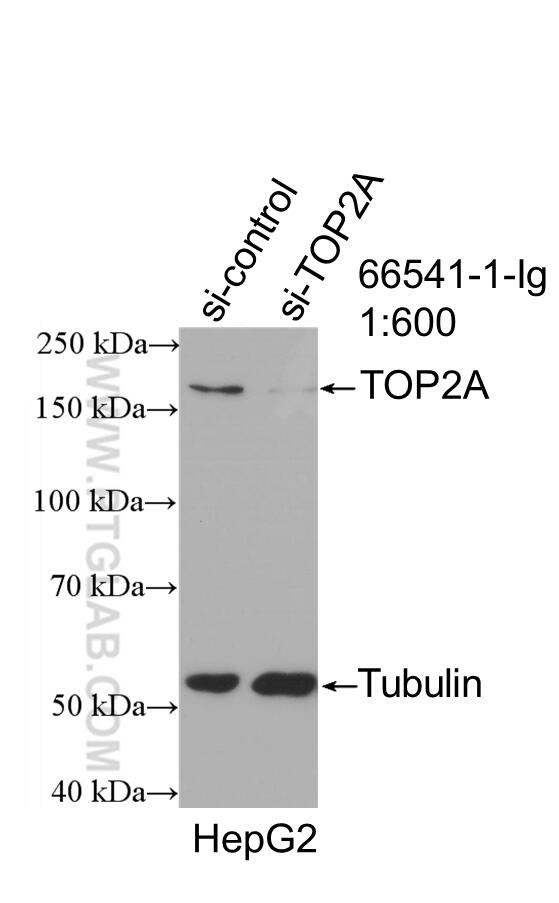 Western Blot (WB) analysis of HepG2 cells using TOP2A Monoclonal antibody (66541-1-Ig)