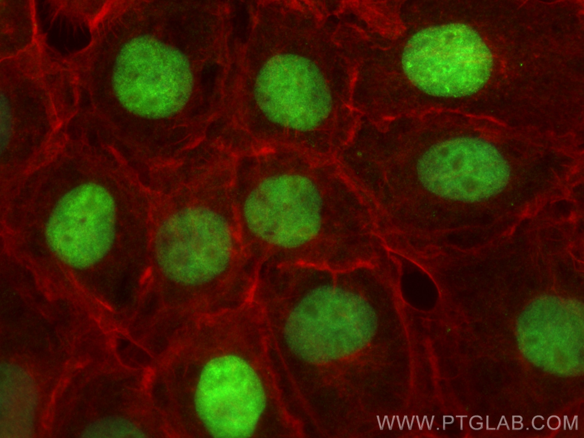 Immunofluorescence (IF) / fluorescent staining of A431 cells using TOP2A Recombinant antibody (82738-4-RR)