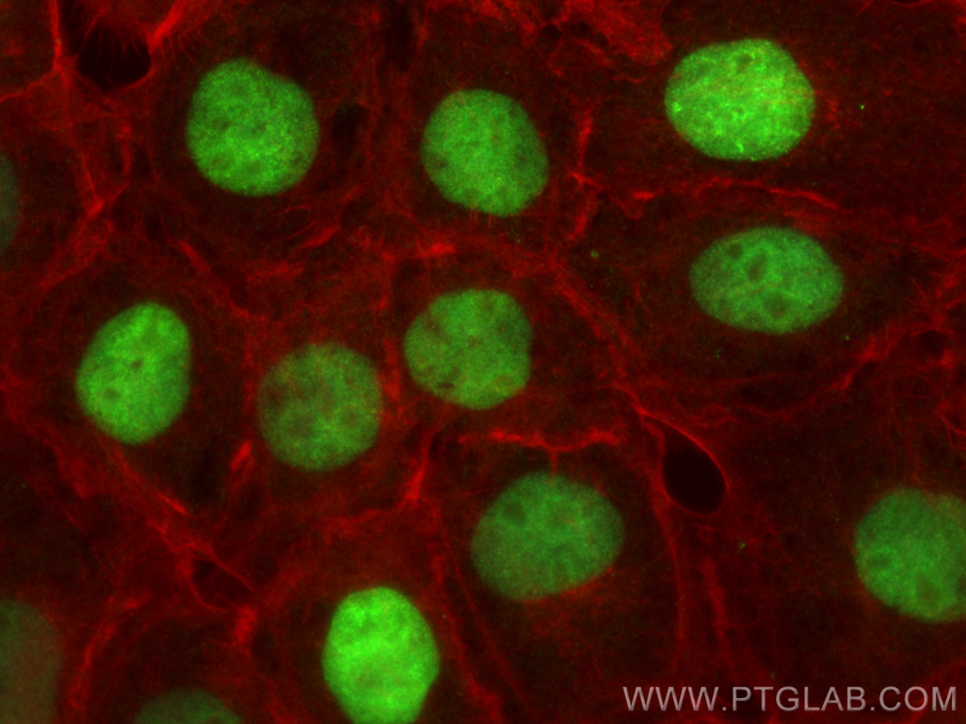 IF Staining of A431 using 82738-4-RR