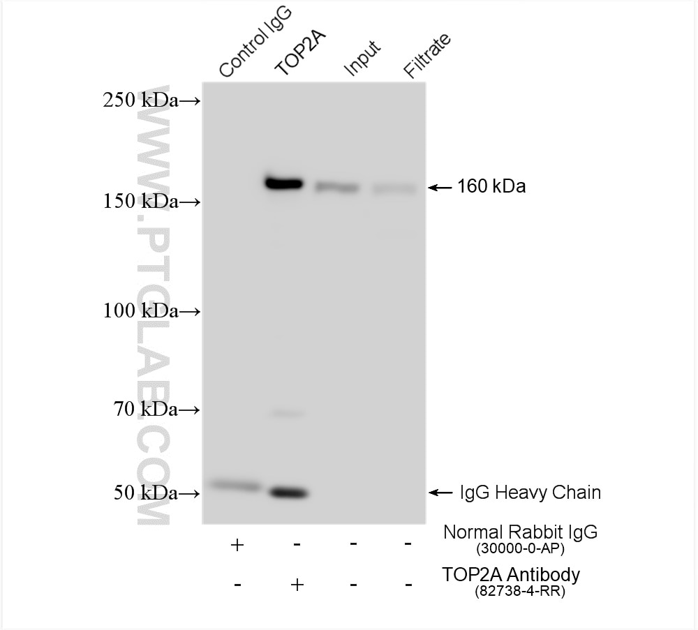 Immunoprecipitation (IP) experiment of HeLa cells using TOP2A Recombinant antibody (82738-4-RR)