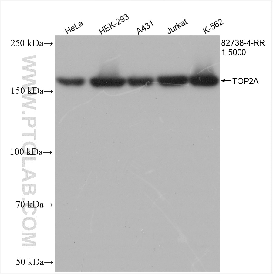 Western Blot (WB) analysis of various lysates using TOP2A Recombinant antibody (82738-4-RR)