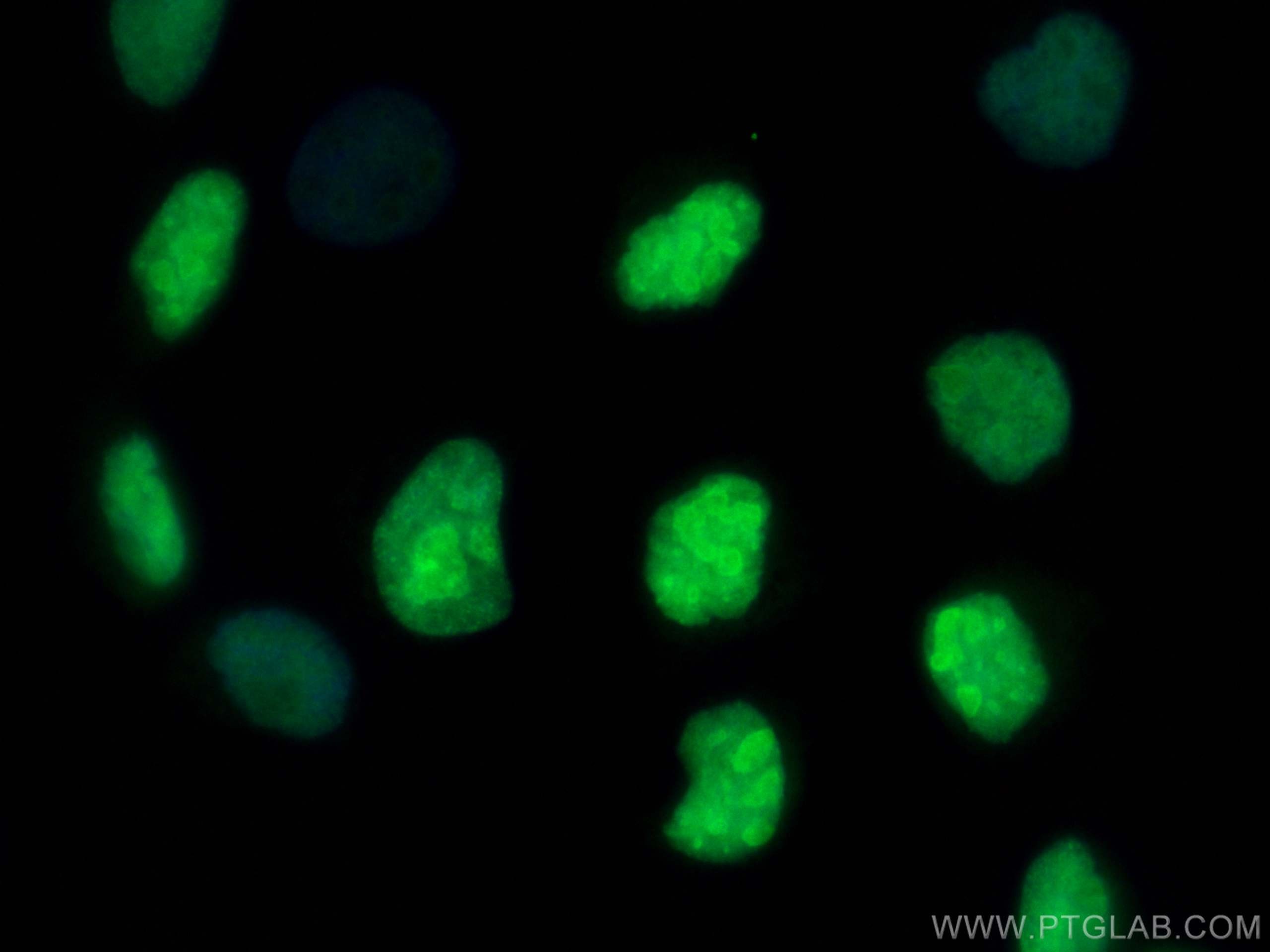 Immunofluorescence (IF) / fluorescent staining of A431 cells using CoraLite® Plus 488-conjugated TOP2A Polyclonal ant (CL488-24641)