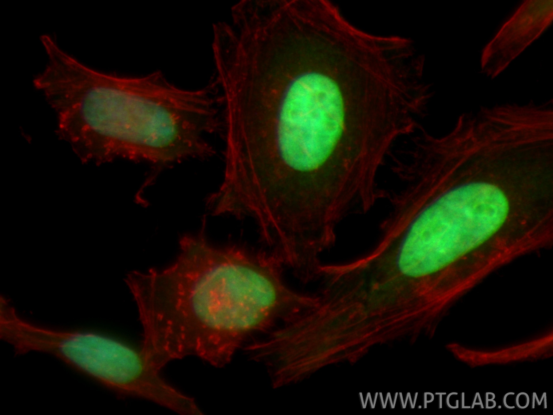 Immunofluorescent analysis of (4% PFA) fixed HeLa cells using CoraLite® Plus 488 TOP2A antibody (CL488-24641) at dilution of 1:200, CL594-phalloidin (red). Immunofluorescence (IF) / fluorescent staining of HeLa cells using CoraLite® Plus 488-conjugated TOP2A Polyclonal ant (CL488-24641)