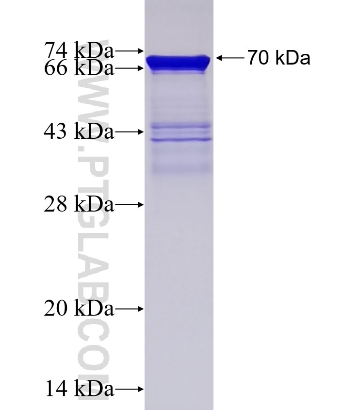TOP2A fusion protein Ag19551 SDS-PAGE