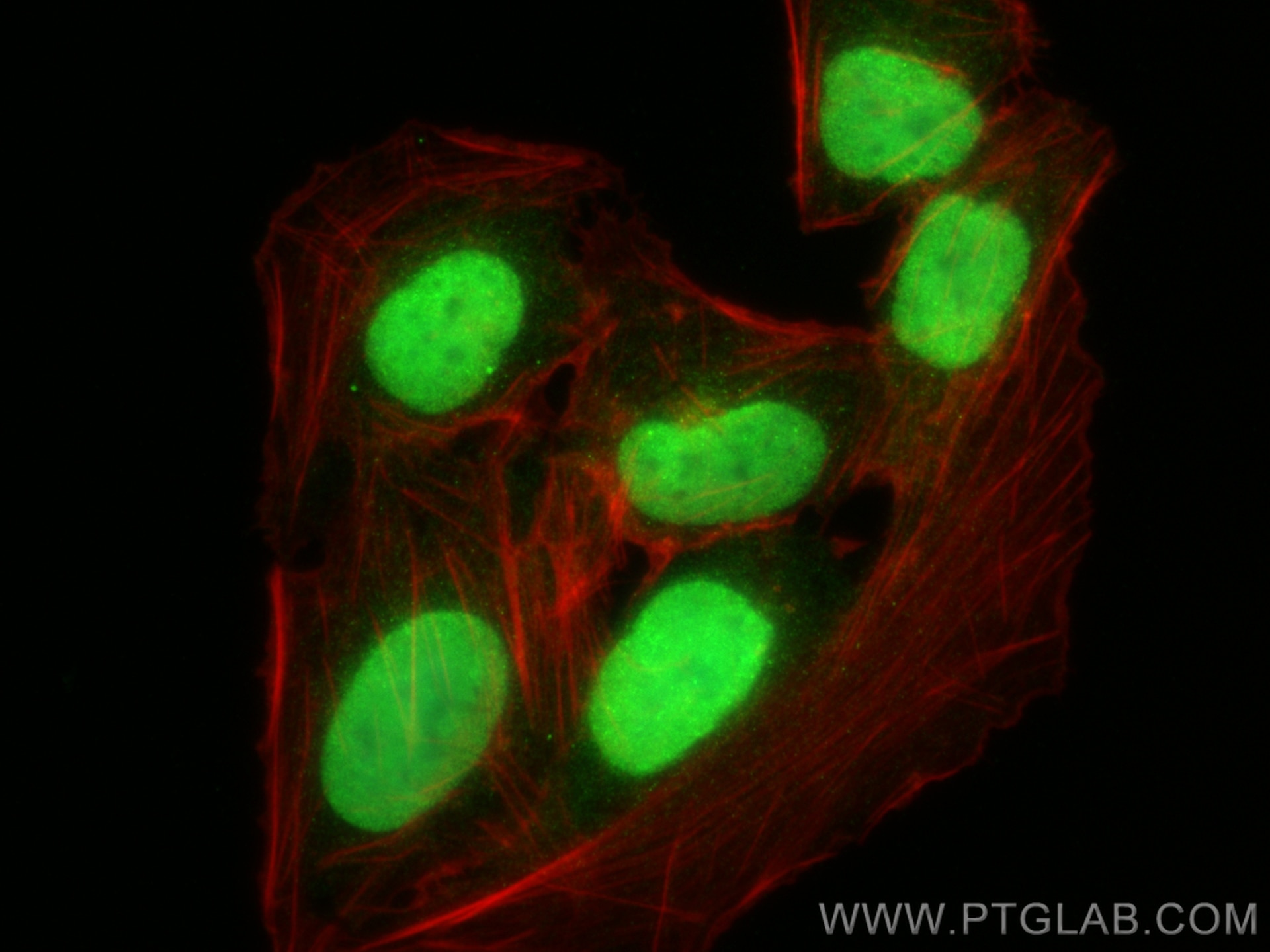 Immunofluorescence (IF) / fluorescent staining of U2OS cells using TOP2A-Specific Polyclonal antibody (20233-1-AP)