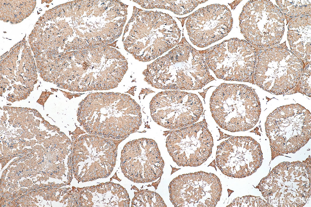 Immunohistochemistry (IHC) staining of mouse testis tissue using TOP2A-Specific Polyclonal antibody (20233-1-AP)