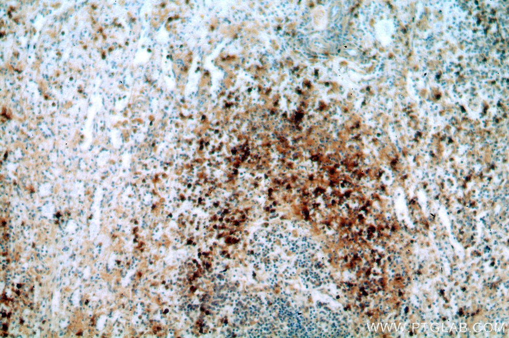 Immunohistochemistry (IHC) staining of human spleen tissue using TOP2A-Specific Polyclonal antibody (20233-1-AP)