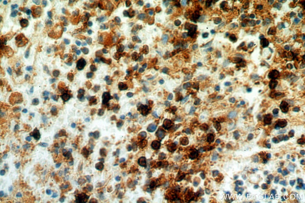 Immunohistochemistry (IHC) staining of human spleen tissue using TOP2A-Specific Polyclonal antibody (20233-1-AP)