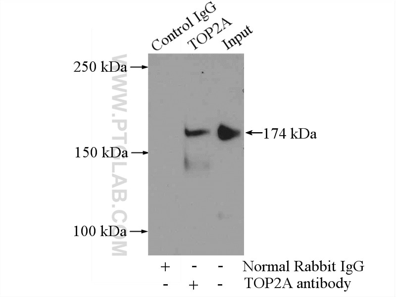 Immunoprecipitation (IP) experiment of HeLa cells using TOP2A-Specific Polyclonal antibody (20233-1-AP)