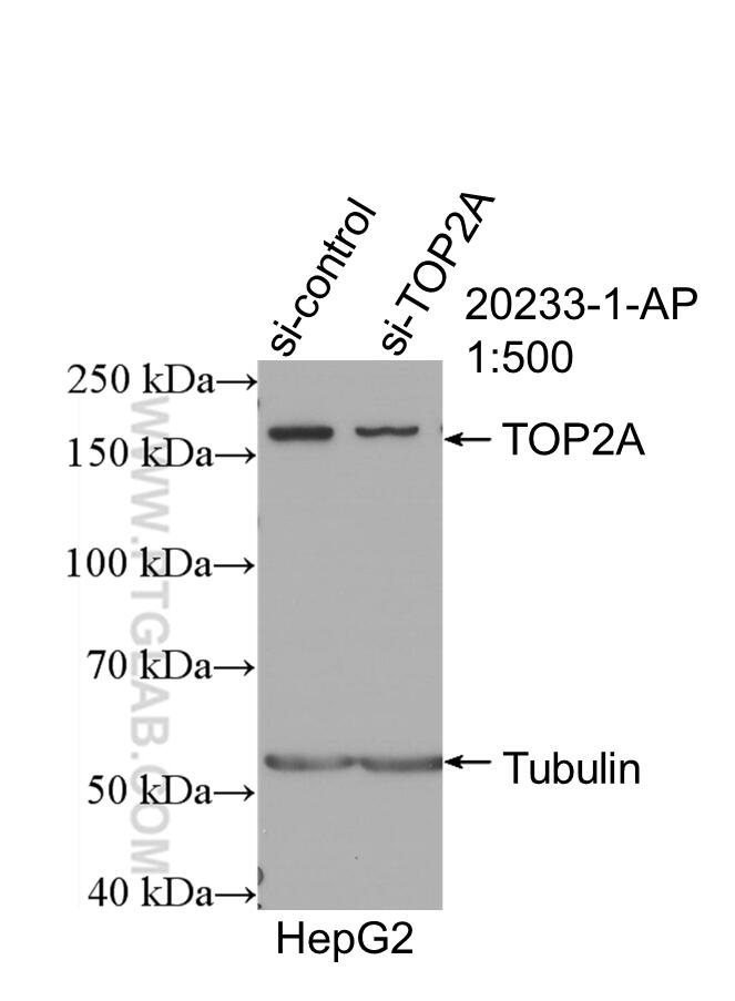 Western Blot (WB) analysis of HepG2 cells using TOP2A-Specific Polyclonal antibody (20233-1-AP)