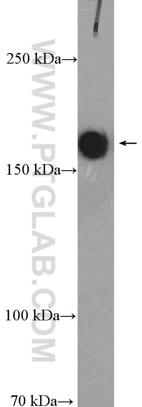 Western Blot (WB) analysis of L02 cells using TOP2A-Specific Polyclonal antibody (20233-1-AP)