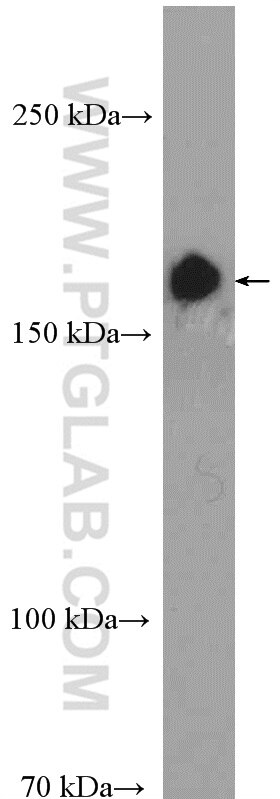 Western Blot (WB) analysis of L02 cells using TOP2A-Specific Polyclonal antibody (20233-1-AP)
