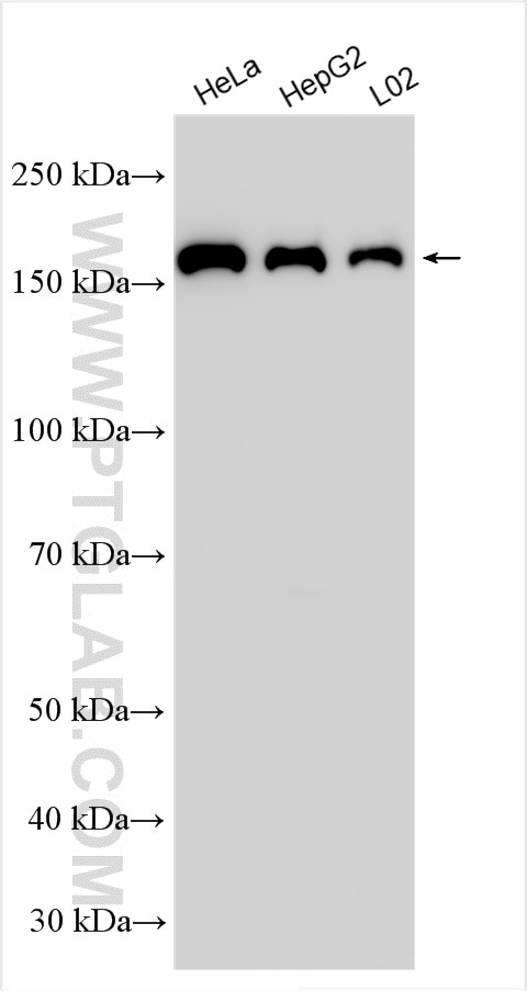 Western Blot (WB) analysis of various lysates using TOP2A-Specific Polyclonal antibody (20233-1-AP)