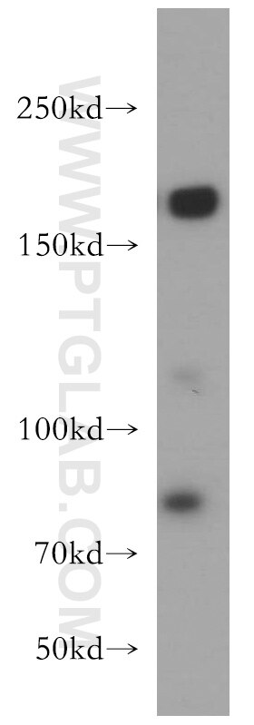Western Blot (WB) analysis of HeLa cells using TOP2A-Specific Polyclonal antibody (20233-1-AP)