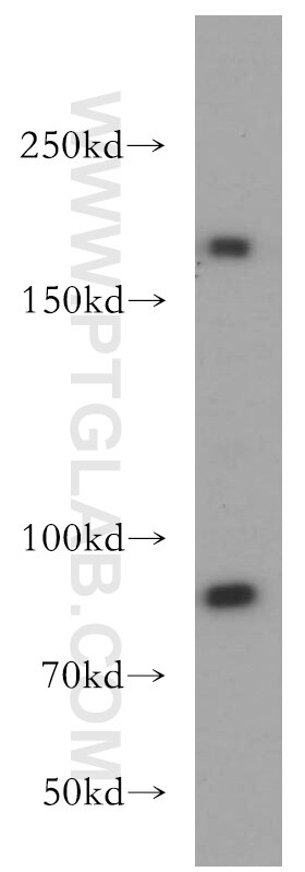 Western Blot (WB) analysis of L02 cells using TOP2A-Specific Polyclonal antibody (20233-1-AP)