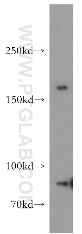 Western Blot (WB) analysis of A431 cells using TOP2A-Specific Polyclonal antibody (20233-1-AP)