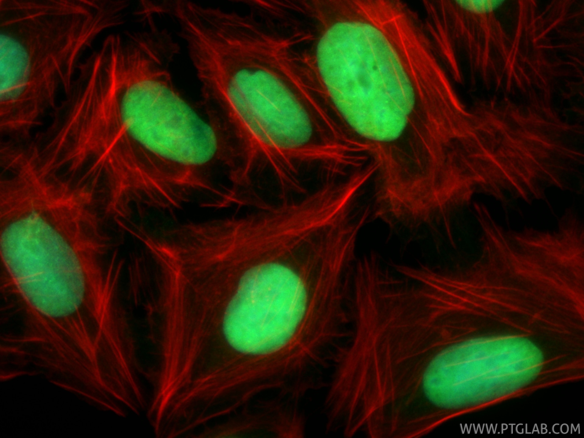 IF Staining of U2OS using 82738-10-RR Immunofluorescence (IF) / fluorescent staining of U2OS cells using TOP2A-Specific Recombinant monoclonal antibody (82738-10-RR)