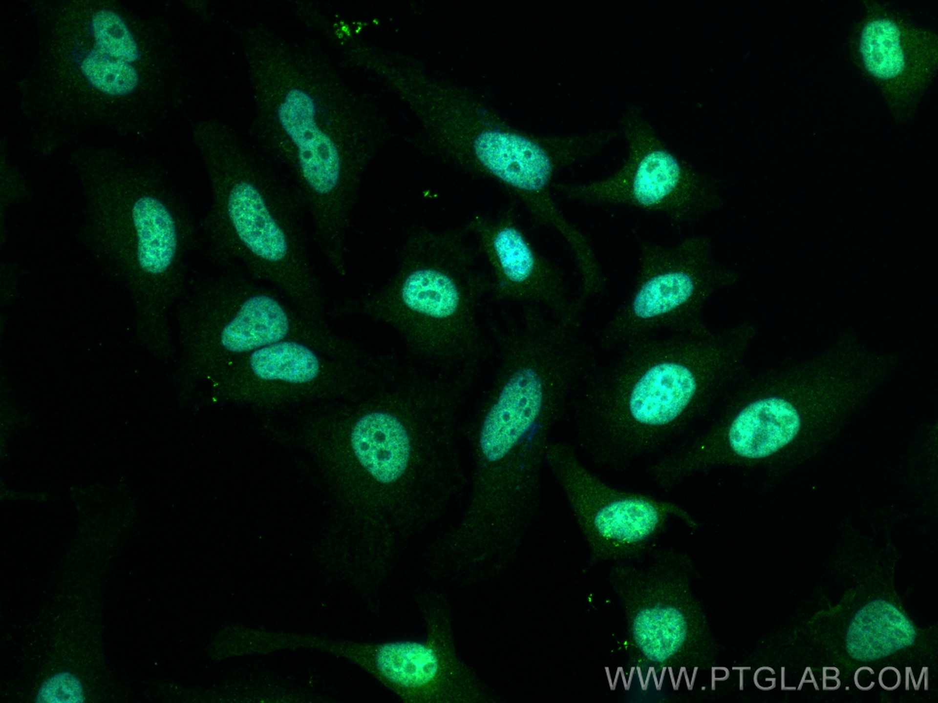 Immunofluorescence (IF) / fluorescent staining of HeLa cells using TOP2B Polyclonal antibody (20549-1-AP)