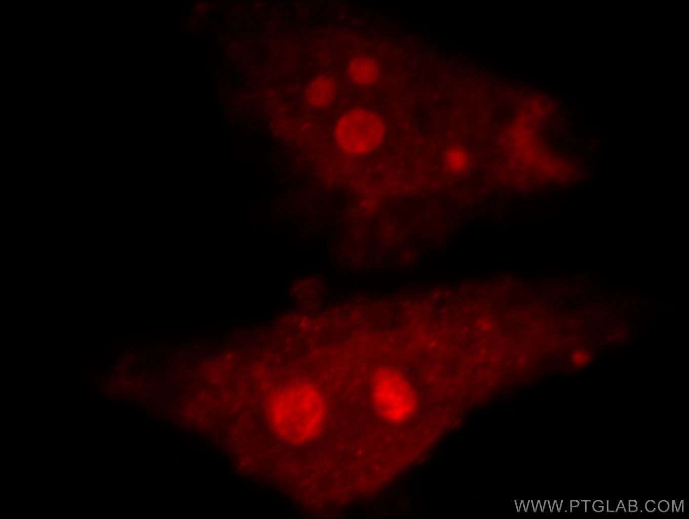 Immunofluorescence (IF) / fluorescent staining of HepG2 cells using TOP2B Polyclonal antibody (20549-1-AP)