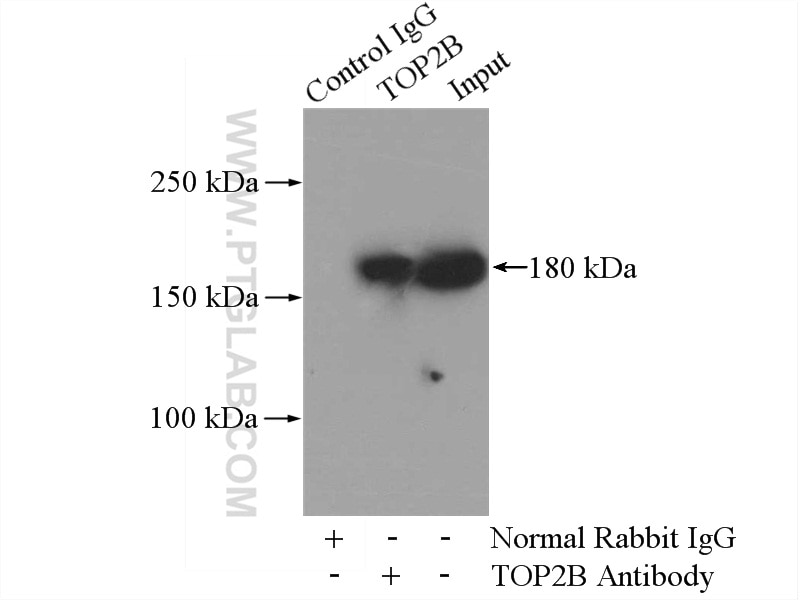 Immunoprecipitation (IP) experiment of HepG2 cells using TOP2B Polyclonal antibody (20549-1-AP)
