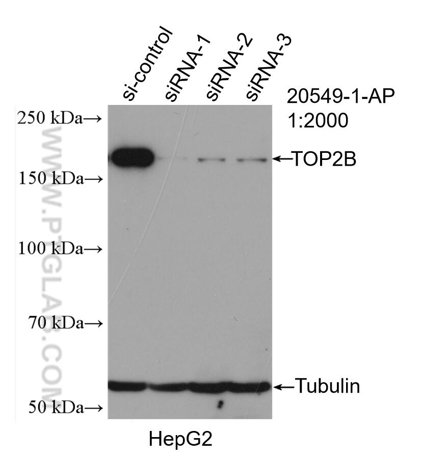 Western Blot (WB) analysis of HepG2 cells using TOP2B Polyclonal antibody (20549-1-AP)