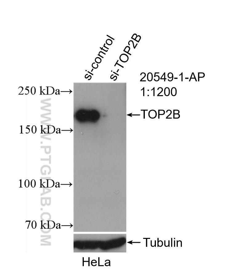 Western Blot (WB) analysis of HeLa cells using TOP2B Polyclonal antibody (20549-1-AP)