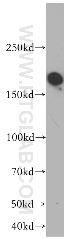 WB analysis of HeLa using 20549-1-AP