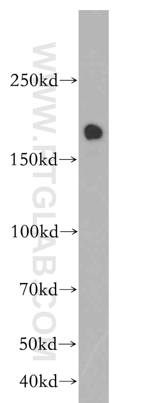 Western Blot (WB) analysis of HeLa cells using TOP2B Polyclonal antibody (20549-1-AP)
