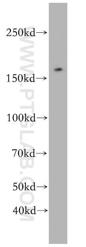 Western Blot (WB) analysis of HepG2 cells using TOP2B Polyclonal antibody (20549-1-AP)