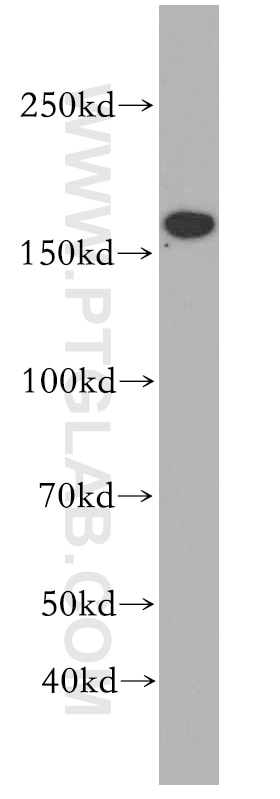 Western Blot (WB) analysis of HepG2 cells using TOP2B Polyclonal antibody (20549-1-AP)