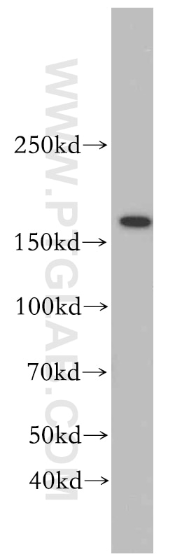 Western Blot (WB) analysis of K-562 cells using TOP2B Polyclonal antibody (20549-1-AP)