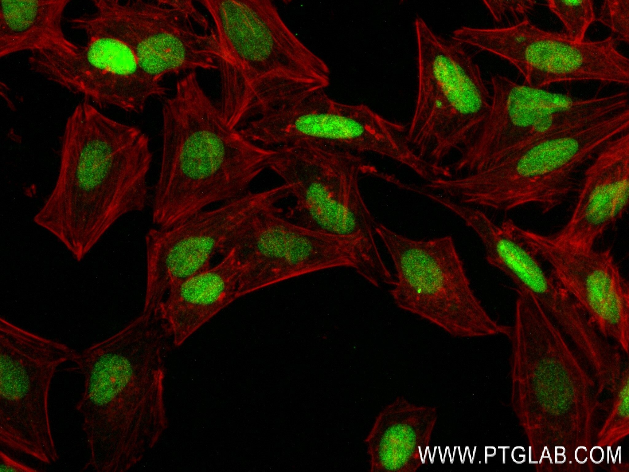 Immunofluorescence (IF) / fluorescent staining of HeLa cells using TOP2B Recombinant antibody (84049-1-RR)