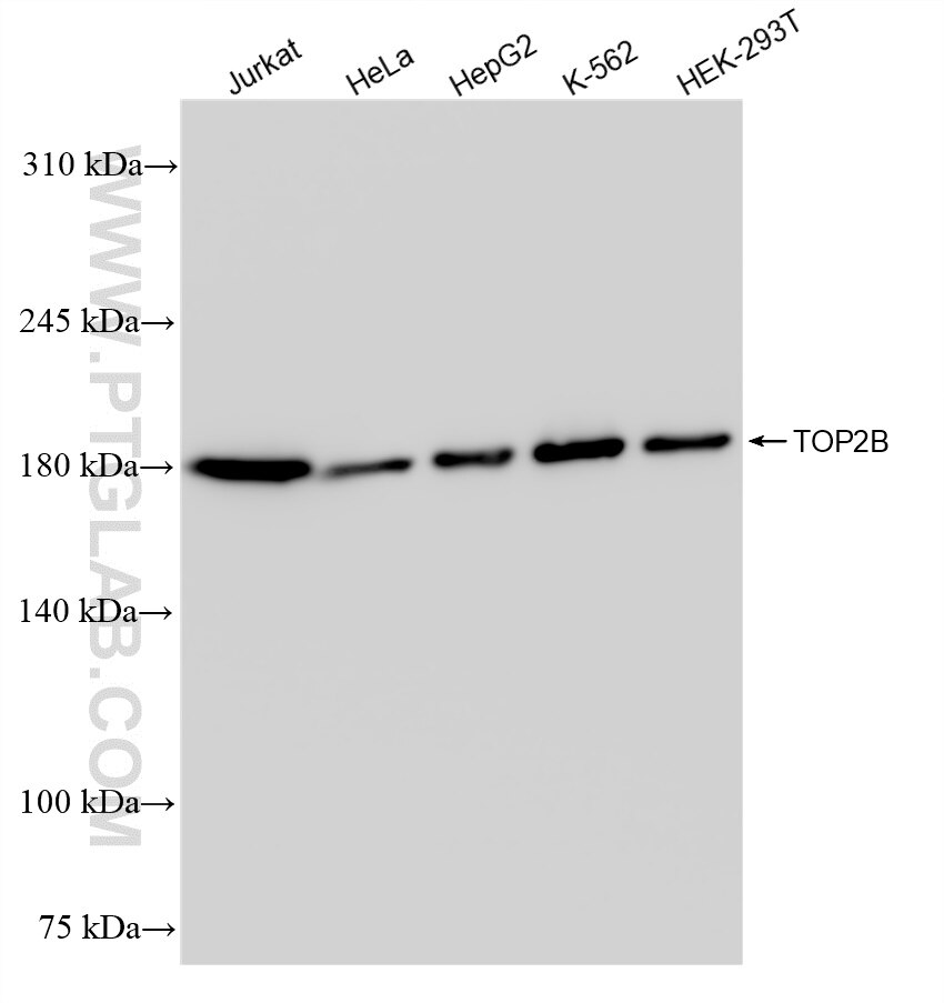 Western Blot (WB) analysis of various lysates using TOP2B Recombinant antibody (84049-1-RR)