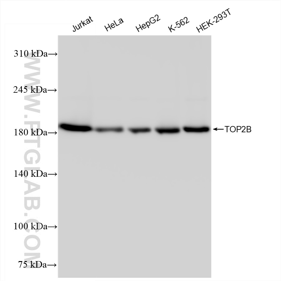 Western Blot (WB) analysis of various lysates using TOP2B Recombinant antibody (84049-2-RR)