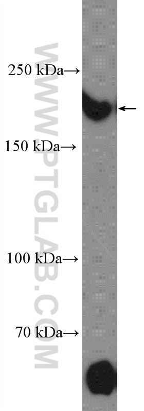 Western Blot (WB) analysis of HeLa cells using TOPBP1 Polyclonal antibody (23340-1-AP)