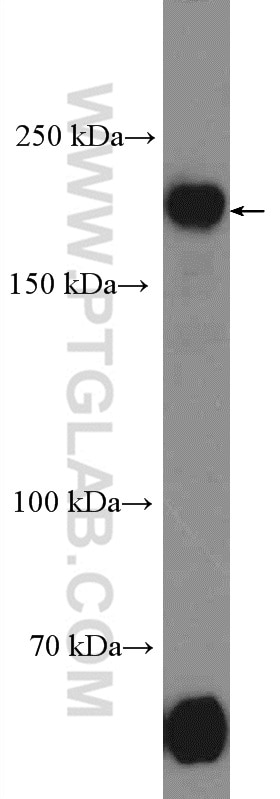 Western Blot (WB) analysis of HeLa cells using TOPBP1 Polyclonal antibody (23340-1-AP)