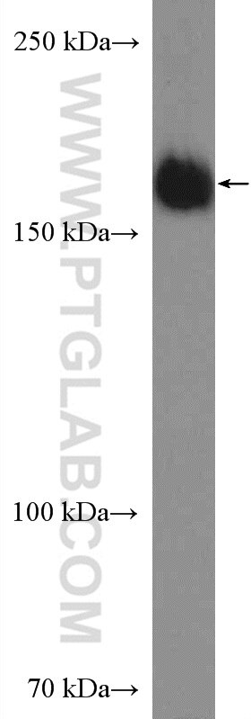 Western Blot (WB) analysis of HeLa cells using TOPBP1 Polyclonal antibody (23340-1-AP)