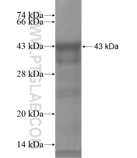 TOPBP1 fusion protein Ag18961 SDS-PAGE