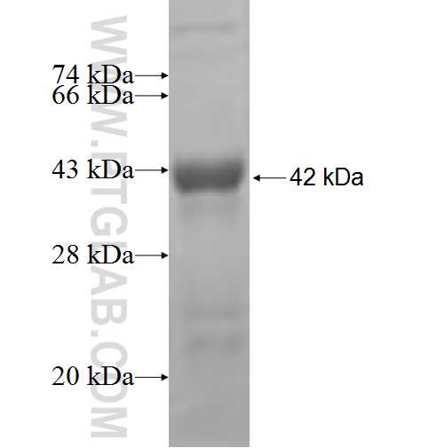 TOPORS fusion protein Ag5407 SDS-PAGE