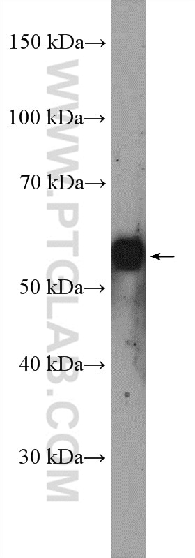 Western Blot (WB) analysis of mouse kidney tissue using Torsin A Polyclonal antibody (10296-1-AP)