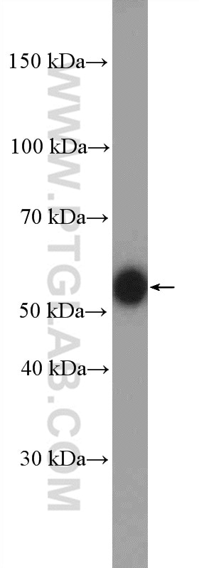 Western Blot (WB) analysis of HEK-293 cells using Torsin A Polyclonal antibody (10296-1-AP)