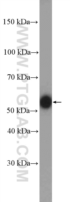 Western Blot (WB) analysis of HEK-293 cells using Torsin A Polyclonal antibody (10296-1-AP)